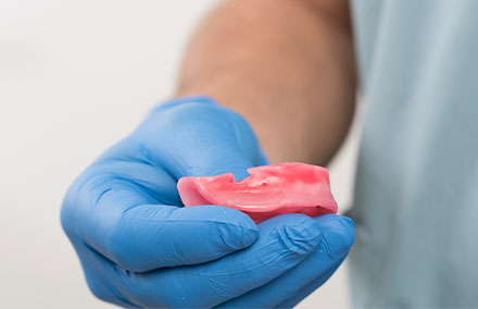 A retentive undercut was incorporated in the mandibular wax rim to affix the registration silicone.
