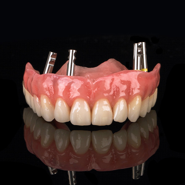 VITA ZAHNFABRIK - une dent artificielle naturellement esthétique VITAPAN  EXCELL - une prothèse ressemblant à la réalité