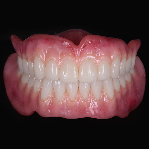 Hot sale Chine modèle de dents artificielles bon marché - Chine Modèle de dents  artificielles, modèle d'étude dentaire
