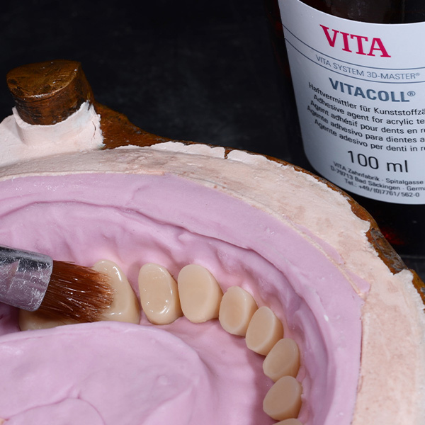 VITAPAN EXCELL and LINGOFORM were conditioned with VITACOLL to ensure good adhesion to the base.