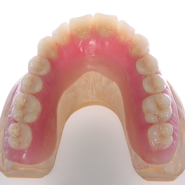 El montaje en cera se realizó con los dientes VITAPAN EXCELL Anterior y VITA PHYSIODENS Posterior.