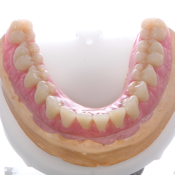 El montaje en cera se realizó con los dientes VITAPAN EXCELL Anterior y VITA PHYSIODENS Posterior.