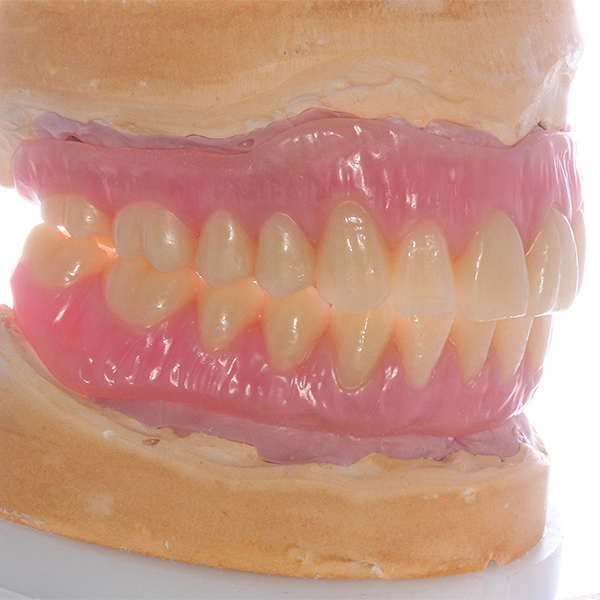 Los dientes VITA PHYSIODENS posibilitaron un montaje eficiente en el grupo posterior.