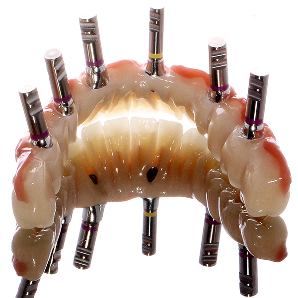 La superficie de apoyo basal reducida garantiza una buena limpieza alrededor de los implantes.