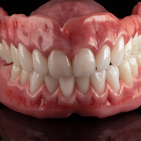 The highly esthetic full denture restoration prior to insertion.