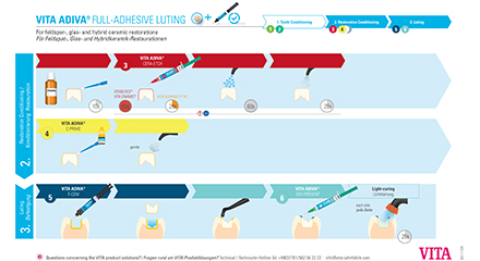 Flujo de trabajo para la fijación completamente adhesiva de coronas de dióxido de circonio. Flujo de trabajo para la fijación completamente adhesiva de coronas de dióxido de circonio.