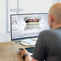 Monolithic, time-efficient front tooth restoration