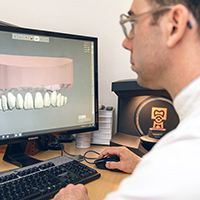 Monolithic, time-efficient front tooth restoration