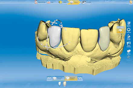 inLab software using the biogeneric function