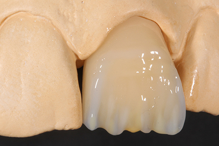 VITA EFFECT ENAMEL flow EE2 and EE5.