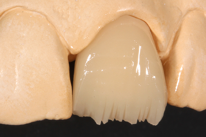 VITA ENAMIC Restoration prepared for individualization.