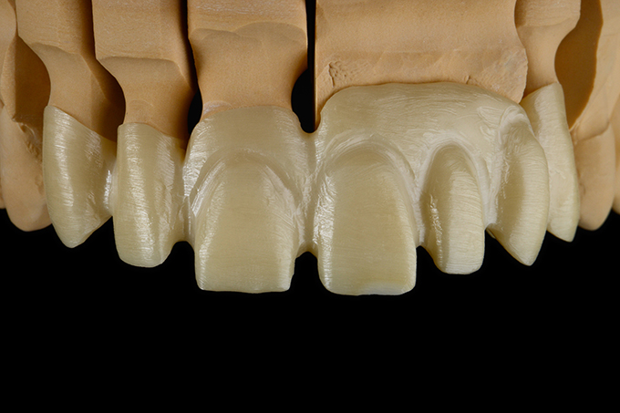 Zirconia framework