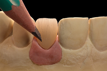 Marking the surface structure