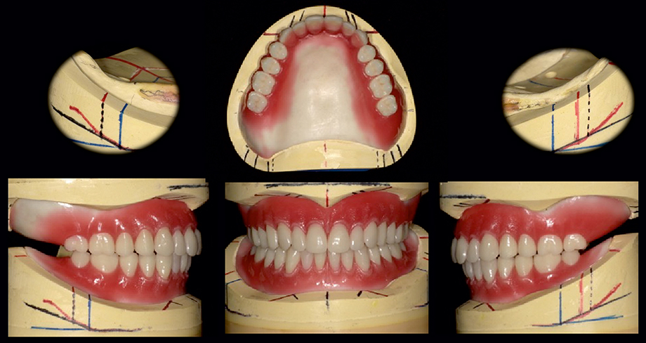 Patient case of Dr. Fumiaki Yamazaki and Toru Odagaki, Japan.