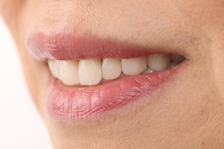 Estética y funcionalmente con dientes anteriores VITAPAN® y dientes posteriores VITA LINGOFORM®.