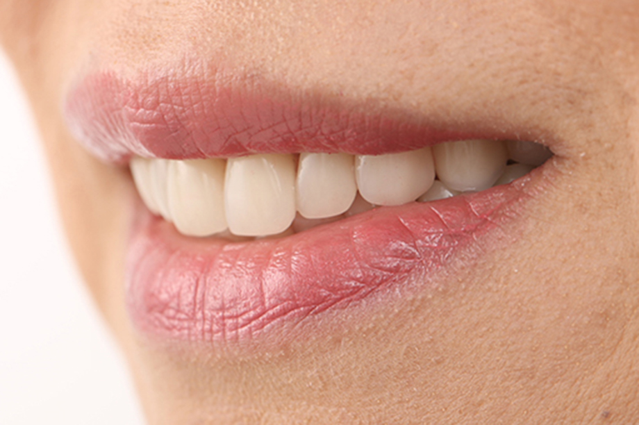 Estética y funcionalmente con dientes anteriores VITAPAN® y dientes posteriores VITA LINGOFORM®.