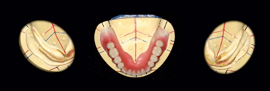 Patient case of Dr. Fumiaki Yamazaki and Toru Odagaki, Japan.