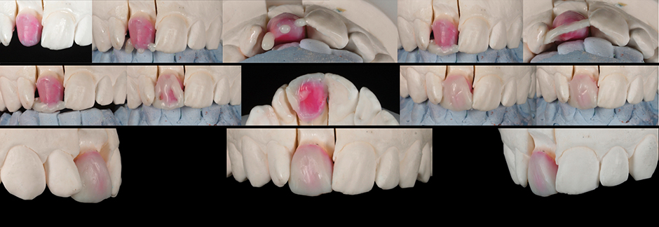 Functional wax model