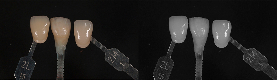 Measurement of the tooth shade