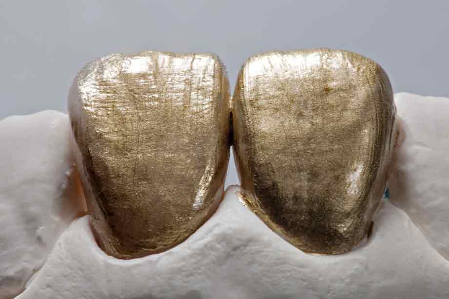 Ill. 14 Le marqueur de texture doré aide à accentuer visuellement la structure de surface. Ill. 14 Le marqueur de texture doré aide à accentuer visuellement la structure de surface.