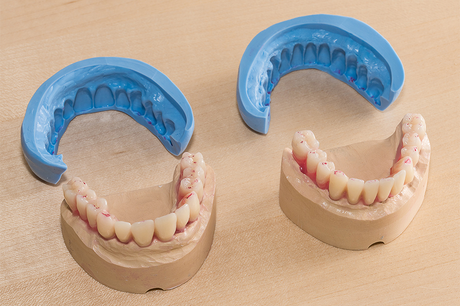 Ill. 3 Les clés en silicone reproduisent les dimensions du
set-up. Ill. 3 Les clés en silicone reproduisent les dimensions du
set-up.