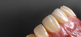 VITA PHYSIODENS®