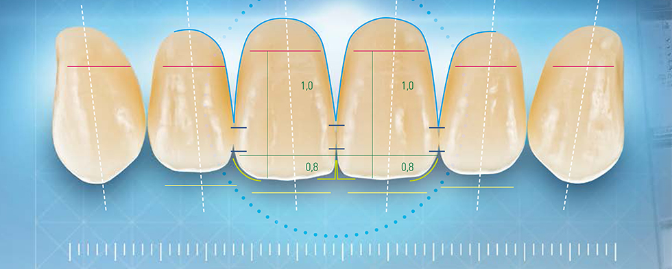 Perfect shape: VITAPAN EXCELL