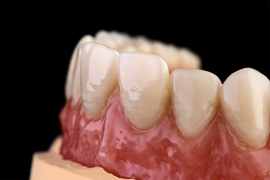 8. The lifelike esthetic zone with VITA MFT Anterior. 8. The lifelike esthetic zone with VITA MFT Anterior.