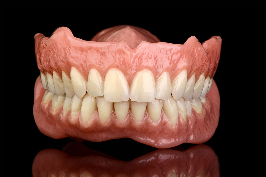 9. Finalized and polished prosthetic restoration. 9. Finalized and polished prosthetic restoration.