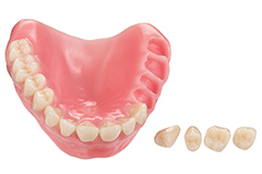 Los dientes de resina encajan en la base de la prótesis conforme al principio de llave-cerradura.