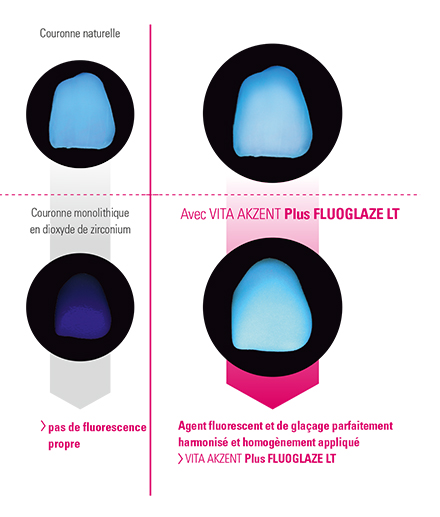 À l'exemple d'une couronne naturelle et des couronnes antérieures en dioxyde de zirconium À l'exemple d'une couronne naturelle et des couronnes antérieures en dioxyde de zirconium